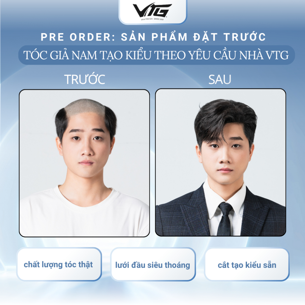 Mô hình 90/10 của VTG Hair kết hợp tạo phom tại trung tâm và hoàn thiện tóc giả trực tiếp tại nhà khách hàng